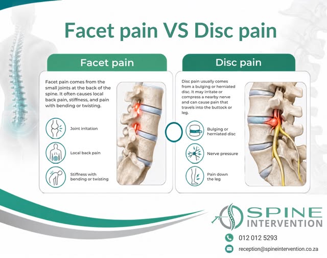 Facet Pain vs Disc Pain