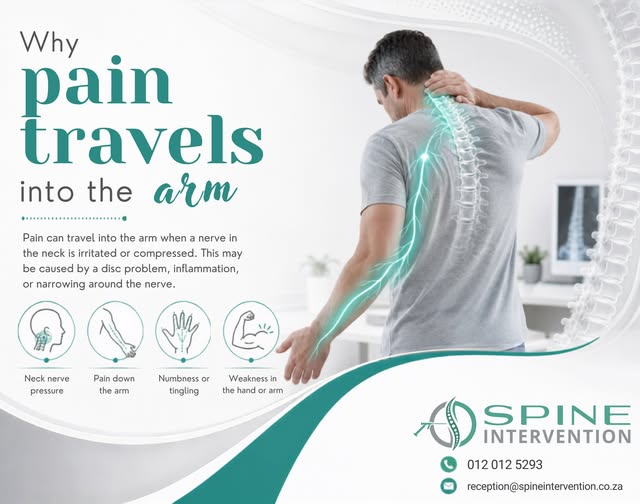 Why Pain Travels into the arm